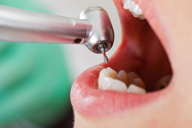 Best Emergency Tooth Extraction in Waldo, AR